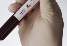 Photo of معلومات عن تحليل hiv وسعره بالتفصيل