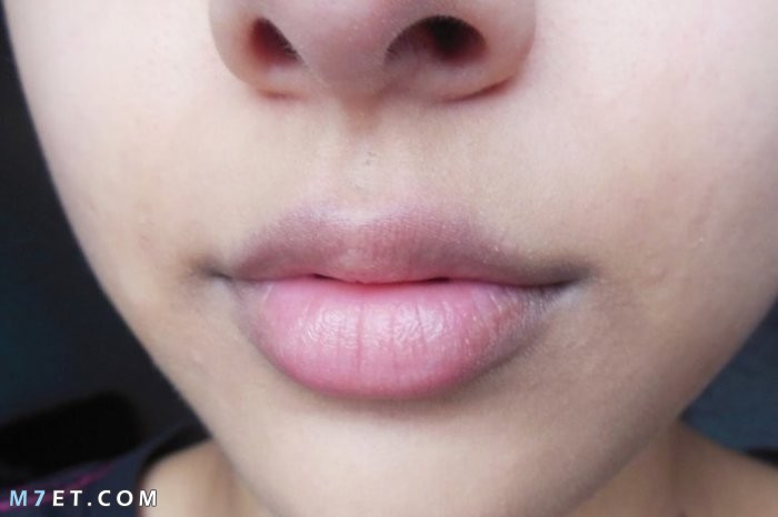 كيفية ازالة الاسمرار حول الفم