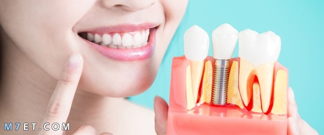المحافظة على الاسنان