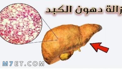 Photo of دواء دهون الكبد وعلاج دهون الكبد بالماء