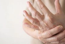 Photo of مرض متلازمة اليد الغريبة alien hand syndrome حقيقة أم خيال