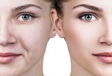 Photo of أفضل طريقة إزالة آثار الحبوب من الوجه مجربة ومضمونة