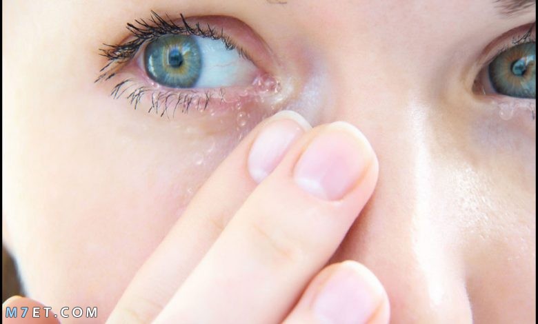 أضرار أشعة الجوال على العين