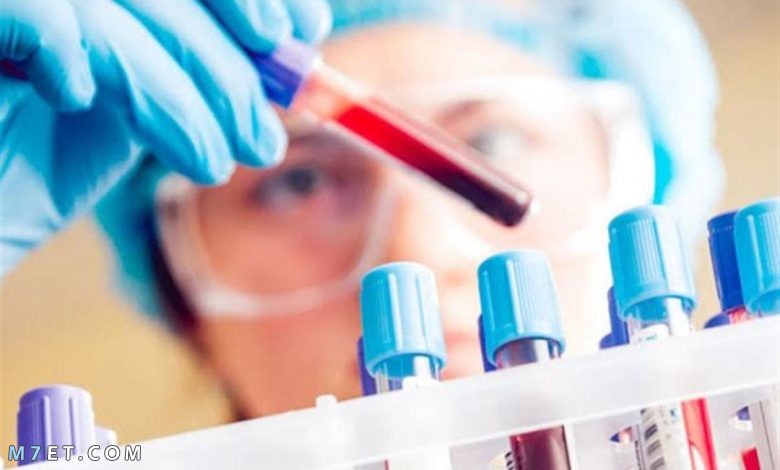 تحليل MCV | كيفية قياس حجم كريات الدم الحمراء 2021
