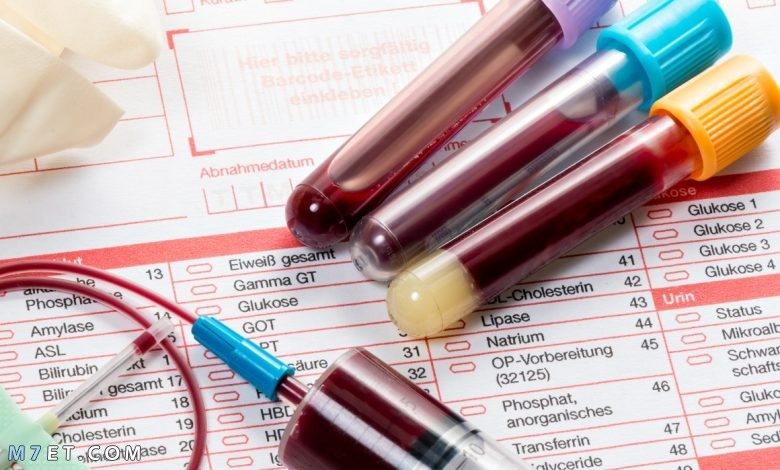 تحليل غازات الدم