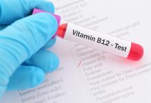 Photo of ما هو تحليل فيتامين ب | Vitamin B analysis