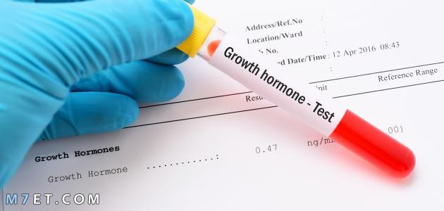 تحليل هرمون النمو