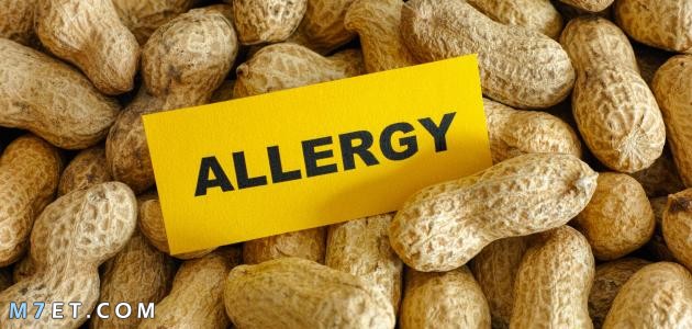 pistachio allergy