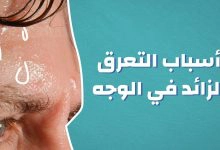 Photo of سبب التعرق الزائد أثناء النوم وعلاجه بالاعشاب