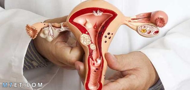  هل نزول إفرازات بنية في موعد الدورة من علامات الحمل