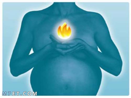  علاج حرقان المعدة للحامل