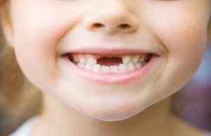 استبدال الأسنان عند الأطفال
