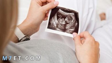 Photo of ما هي أعراض الحمل في الشهر الثالث