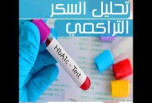 Photo of سعر تحليل السكر التراكمي في مصر والسعودية