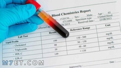 Photo of أهم المعلومات حول قراءة تحليل الدم الشامل