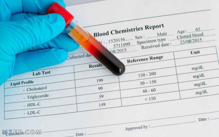 قراءة تحليل الدم الشامل