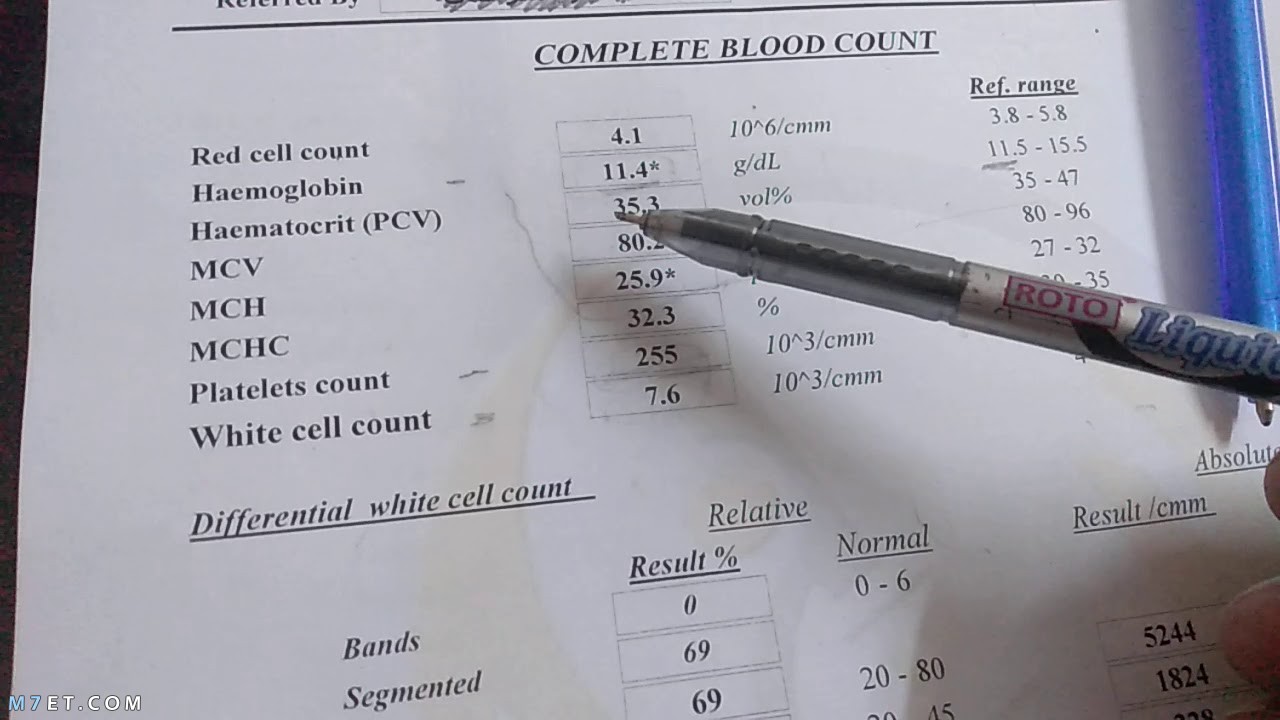 قراءة تحليل الدم الشامل