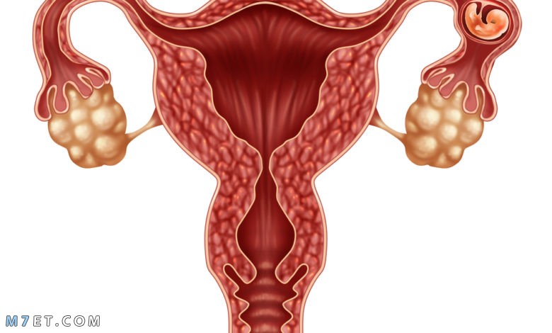 أعراض الحمل خارج الرحم