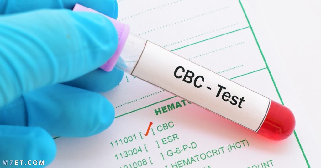 اختصارات اختبار الدم ومعانيها من cbc