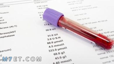Photo of اختصارات تحليل الدم ومعانيها cbc