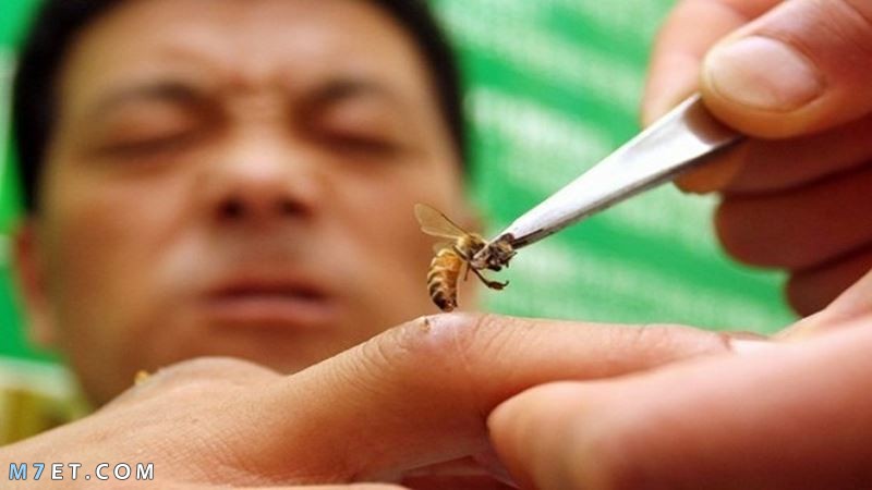 الآثار الجانبية لحقن سم النحل