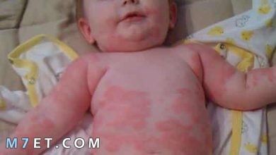 Photo of أهم المعلومات حول حساسية الجلوتين عند الاطفال