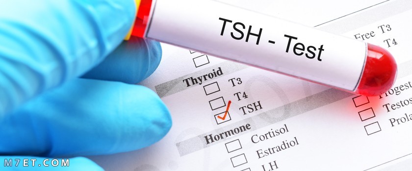 أعراض ارتفاع هرمون الغدة الدرقية TSH
