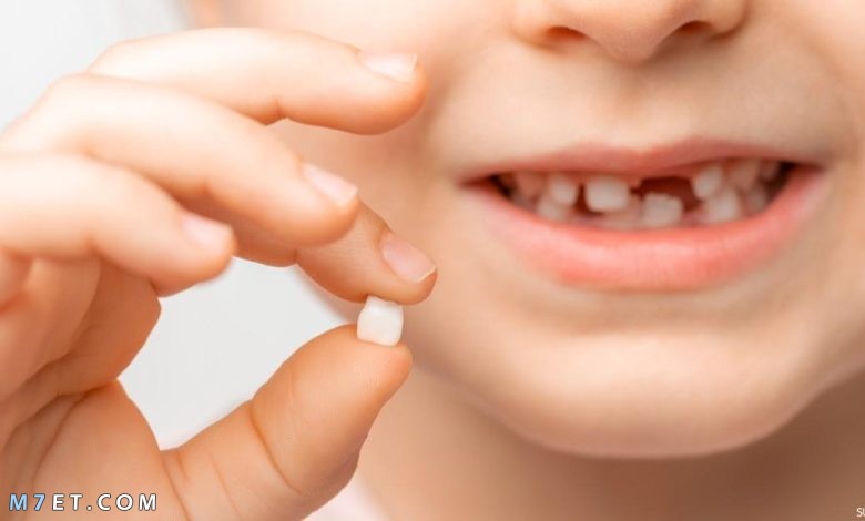 مشاكل تبديل الأسنان عند الأطفال