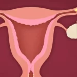 هل ألم الكتف من أعراض الحمل خارج الرحم