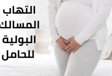 Photo of التهاب البول عند الحامل يضر الجنين