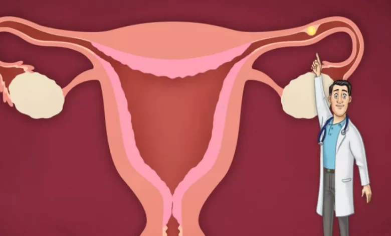 هل ألم الرقبة من علامات الحمل خارج الرحم