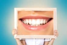 Photo of خدمات تجميل الاسنان