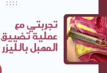 Photo of تجربتي مع عملية تضييق المهبل بالليزر