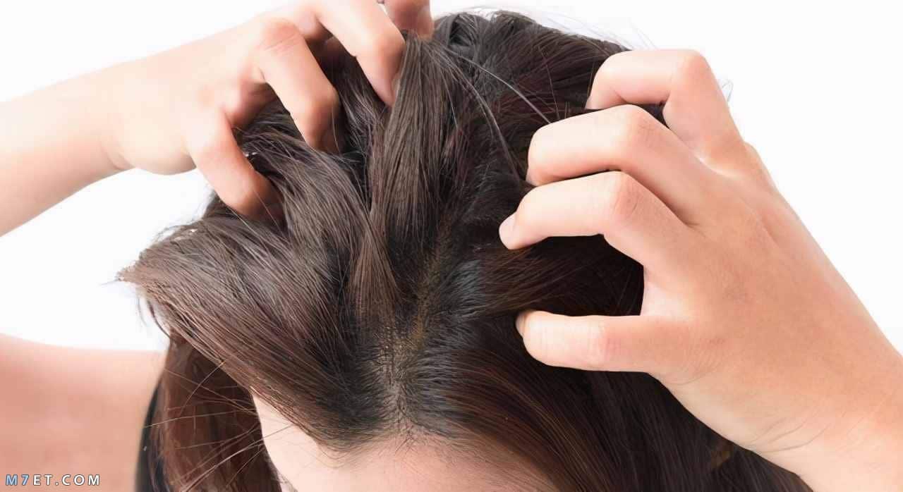 طريقة تقوية بصيلات الشعر بالأعشاب