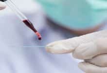 Photo of سعر تحليل الدم الشامل في معمل البرج واسعار التحاليل الاخرى