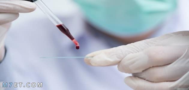 سعر تحليل الدم الشامل
