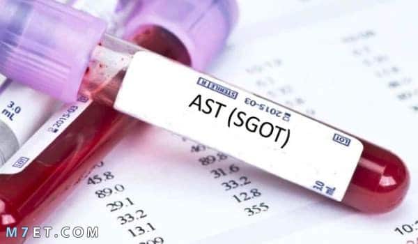 تحليل Ast | ما هو تحليل Ast ولماذا يتم إجراؤه وما هي نتائج فحص الدم الطبيعية لإختبارات وظائف الكبد