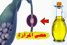 Photo of علاج حصى المرارة بزيت الزيتون 
