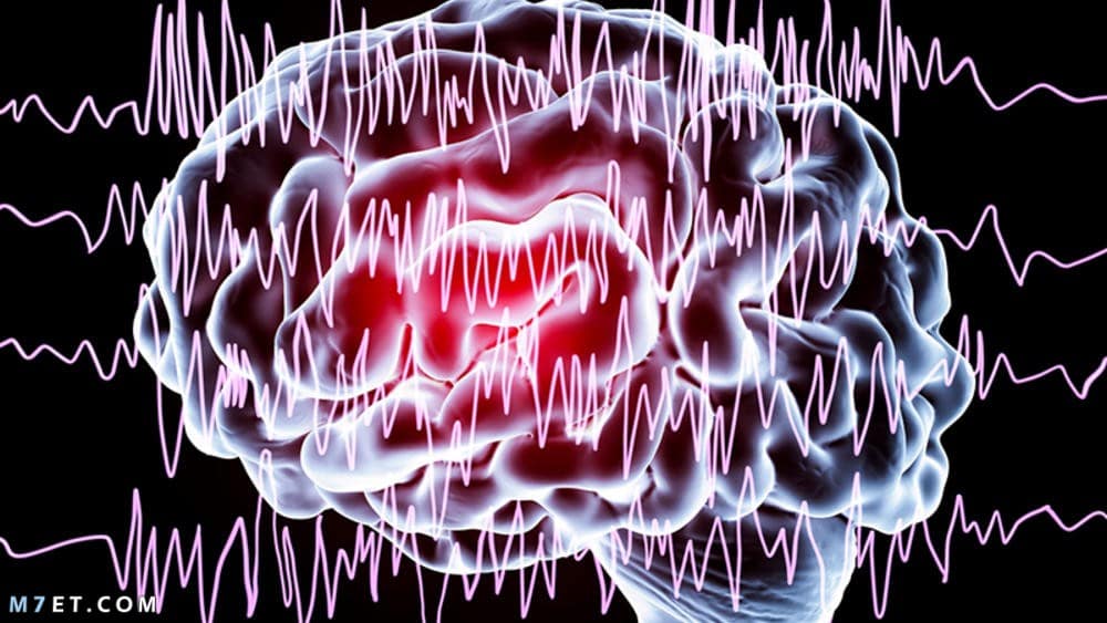 هل يمكن الشفاء من كهرباء المخ؟ 