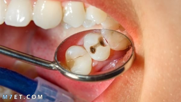 افضل مضاد حيوي لالتهاب عصب الأسنان