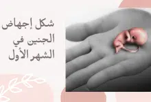 Photo of شكل الجنين إذا سقط في الشهر الأول