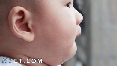 Photo of بقع بيضاء في الوجه عند الاطفال الرضع