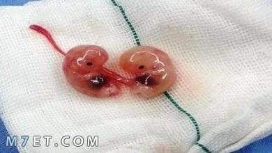 Photo of أشياء تسبب الإجهاض في الشهر الثالت